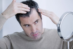 hair loss cbd